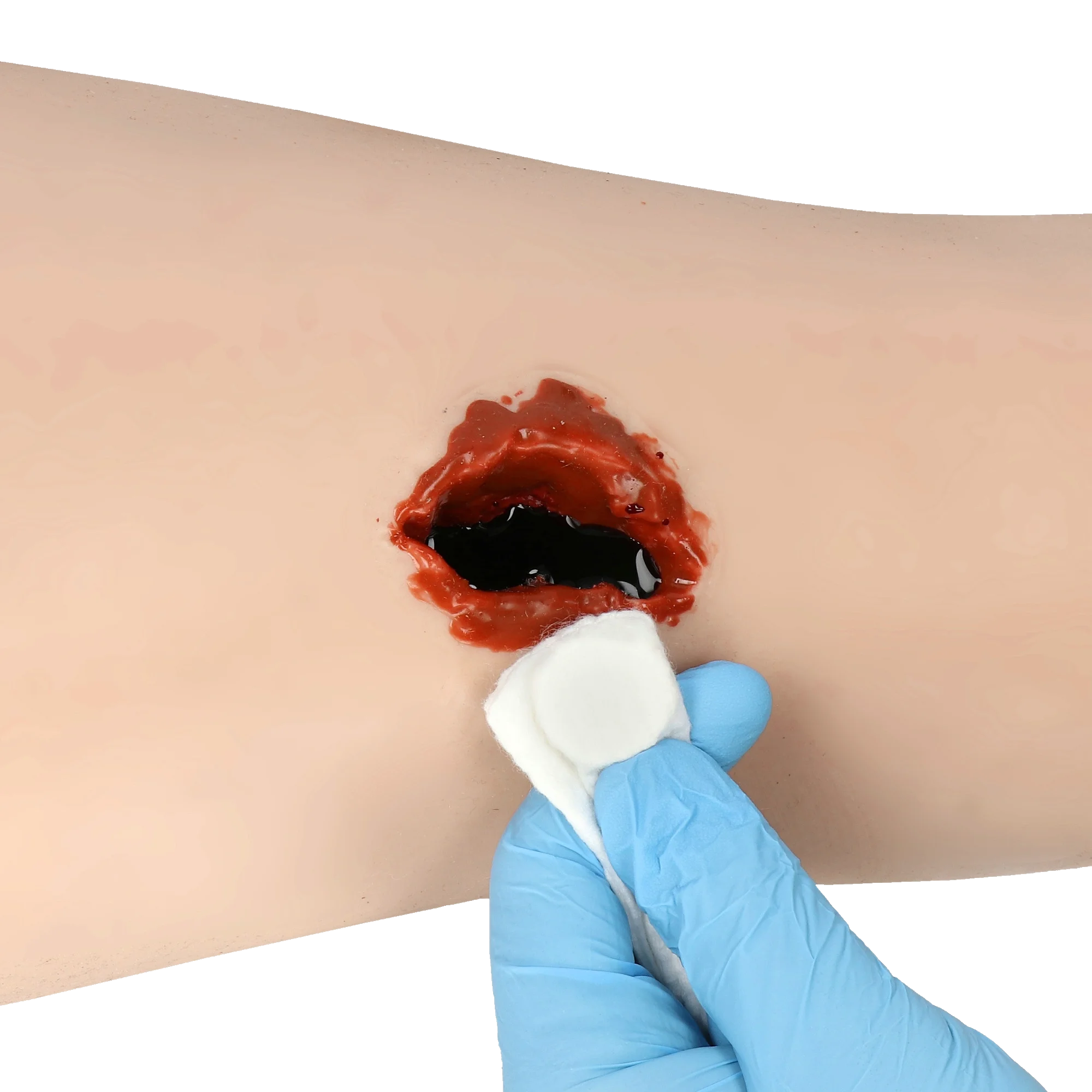 Assess the wound
